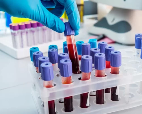 Cómo puedo saber qué tipo de sangre soy en Chile